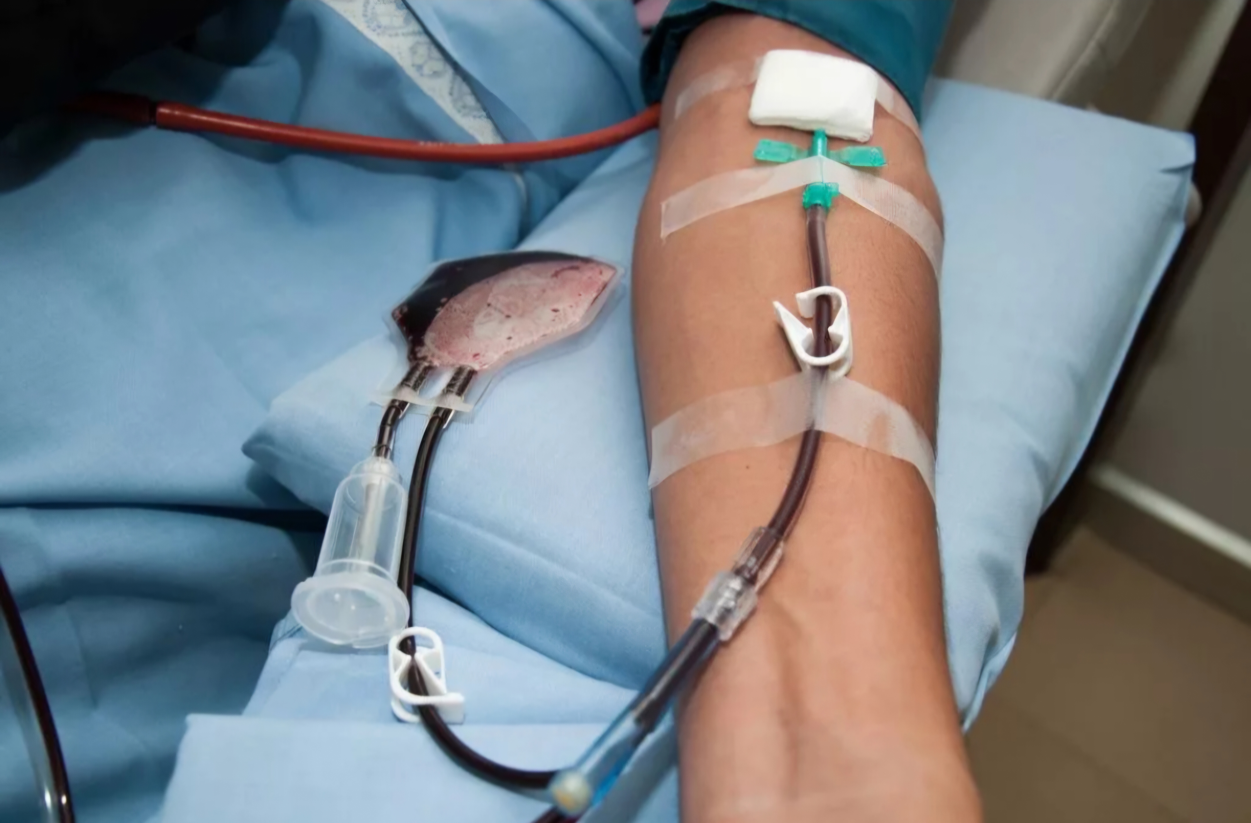 هزینه فصد خون در منزل تهران ۱۴۰۴