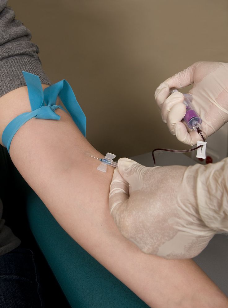 فصد خون در بیمارستان و منزل جردن|شبانه روزی|اعزام فوری پرستار حرفه ای زیر 45دقیقه