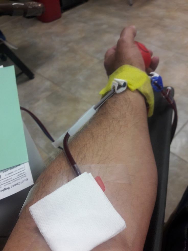 فصد خون در منزل اجودانیه تهران توسط پرستار حرفه‌ای | شبانه‌روزی و اعزام فوری زیر ۴۵ دقیقه